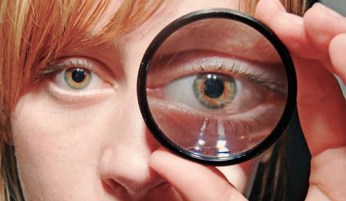 Развитие глаукомы глаз